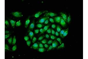 Immunofluorescence staining of A549 cells with ABIN7167205 at 1:66, counter-stained with DAPI. (RRAGA 抗体  (AA 1-247))