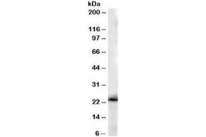 Western blot testing of human kidney lysate with GSTP1 antibody at 0. (GSTP1 抗体)