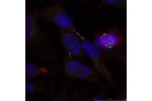 Immunofluorescence staining of methanol-fixed HeLa cells using Elk-1 (Ab-389) antibody (E021037, Red) (ELK1 抗体)