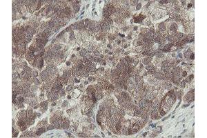 Image no. 1 for anti-OTU Domain, Ubiquitin Aldehyde Binding 1 (OTUB1) antibody (ABIN1499930) (OTUB1 抗体)