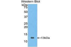Detection of Recombinant PIGR, Bovine using Polyclonal Antibody to Polymeric Immunoglobulin Receptor (PIGR)