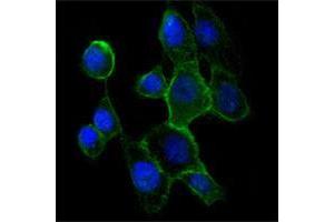 Immunofluorescence analysis of A431 cells using CDH2 mouse mAb (green). (N-Cadherin 抗体)