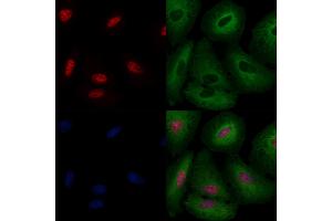 ABIN6259637 and ABIN6274424 staining  cells by IF/ICC.