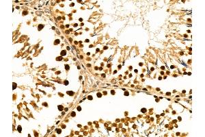 ABIN6258843 and ABIN6274212 at 1/100 staining Rat testis tissue by IHC-P. (HMGB2 抗体  (Internal Region))