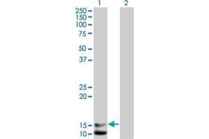 Western Blot analysis of NPPB expression in transfected 293T cell line by NPPB monoclonal antibody (M01), clone 2D11. (NPPB 抗体  (AA 1-134))