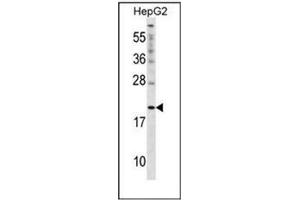 Western blot analysis of Cytoglobin (N-term) in HepG2 cell line lysates (35ug/lane). (CYGB 抗体  (N-Term))