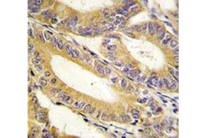 Immunohistochemistry (IHC) image for anti-X-Linked Inhibitor of Apoptosis (XIAP) (AA 1-30) antibody (ABIN3029644)