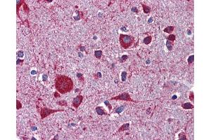Immunohistochemistry (IHC) image for anti-Low Density Lipoprotein Receptor-Related Protein 8, Apolipoprotein E Receptor (LRP8) (Middle Region) antibody (ABIN2781990) (LRP8 抗体  (Middle Region))