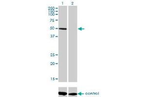 Western blot analysis of ZNF277 over-expressed 293 cell line, cotransfected with ZNF277 Validated Chimera RNAi (Lane 2) or non-transfected control (Lane 1). (ZNF277 抗体  (AA 1-278))