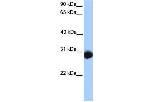WB Suggested Anti-SLAMF6 Antibody Titration:  0. (SLAMF6 抗体  (N-Term))