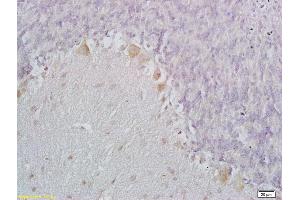 Formalin-fixed and paraffin embedded mouse brain labeled with Anti-C1QL1 Polyclonal Antibody, Unconjugated (ABIN1385147) at 1:200 followed by conjugation to the secondary antibody and DAB staining