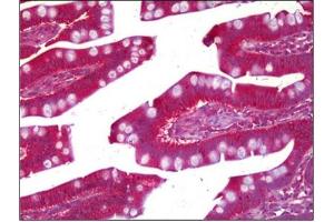 Immunohistochemistry (IHC) image for anti-Prune Exopolyphosphatase (PRUNE) antibody (ABIN954343) (PRUNE 抗体)