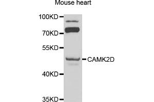Western blot analysis of extracts of mouse heart, using CAMK2D antibody (ABIN1871415) at 1:1000 dilution. (CAMK2D 抗体)