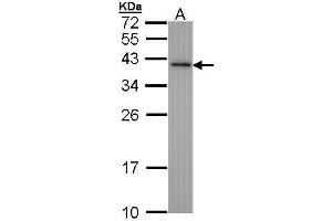 WB Image Sample (30 ug of whole cell lysate) A: Hep G2 , 12% SDS PAGE antibody diluted at 1:1000 (NHEJ1 抗体)