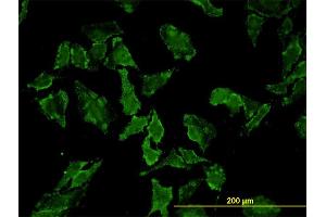 Immunofluorescence of monoclonal antibody to HFE on HeLa cell. (HFE 抗体  (AA 115-205))