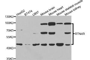 Western blot analysis of extracts of various cell lines, using RTN4R antibody (ABIN5973458) at 1/1000 dilution. (RTN4R 抗体)