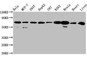 Western Blot Positive WB detected in: Hela whole cell lysate, MCF-7 whole cell lysate, 293T whole cell lysate, HepG2 whole cell lysate, U87 whole cell lysate, K562 whole cell lysate, Rat brain tissue, Mouse heart tissue, Mouse liver tissue All lanes: SLCO2A1 antibody at 2. (SLCO2A1 抗体  (AA 416-518))