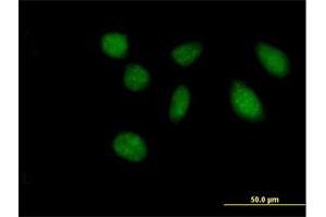 Immunofluorescence of purified MaxPab antibody to FAM47B on HeLa cell. (FAM47B 抗体  (AA 1-645))