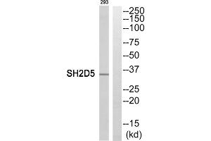 Western blot analysis of extracts from 293 cells, using SH2D5 antibody. (SH2D5 抗体  (C-Term))