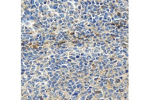 IHC analysis of CLEC9A using anti-CLEC9A antibody (ABIN6719546).