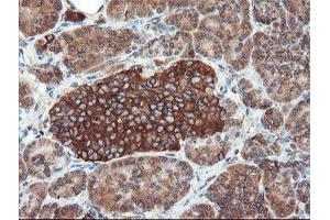 Image no. 5 for anti-Ubiquitin Specific Peptidase 9, X-Linked (USP9X) (AA 2246-2570) antibody (ABIN1491228)