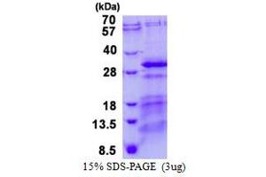 Charged Multivesicular Body Protein 5 (CHMP5) (AA 1-219) protein (His tag)