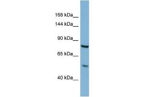 Host:  Rabbit  Target Name:  GALNT5  Sample Type:  COLO205 Whole Cell lysates  Antibody Dilution:  1. (GALNT5 抗体  (C-Term))