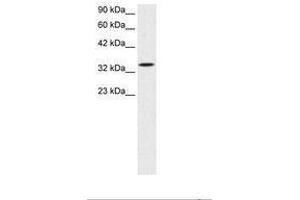Image no. 3 for anti-SMAD, Mothers Against DPP Homolog 6 (SMAD6) (AA 137-182) antibody (ABIN202662) (SMAD6 抗体  (AA 137-182))