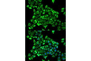 Immunofluorescence (IF) image for anti-Cytidine Deaminase (CDA) antibody (ABIN1871668) (CDA 抗体)