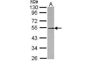WB Image Sample (30 ug of whole cell lysate) A: Raji 10% SDS PAGE antibody diluted at 1:1000 (DOK1 抗体)