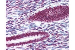 Anti-Estrogen Receptor antibody IHC of human uterus.
