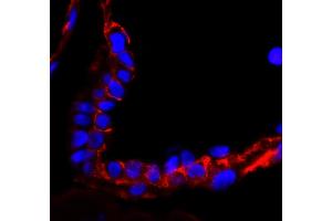 Immunofluorescence (IF) image for anti-Epidermal Growth Factor Receptor (EGFR) (C-Term) antibody (ABIN7448958)
