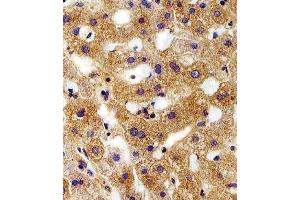 Immunohistochemical analysis of paraffin-embedded H. (FXYD6 抗体  (C-Term))