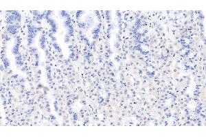 Detection of LSR in Human Stomach Tissue using Monoclonal Antibody to Lipolysis Stimulated Lipoprotein Receptor (LSR) (LSR 抗体  (AA 335-589))