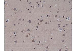 IHC testing of formalin fixed and paraffin embedded human brain tissue with recombinant LC3B antibody at 1:200 dilution. (Recombinant LC3B 抗体  (N-Term))