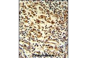 Formalin-fixed and paraffin-embedded human lymph reacted with HMHA1 Antibody (Center), which was peroxidase-conjugated to the secondary antibody, followed by DAB staining. (HMHA1 抗体  (AA 877-903))