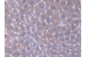 DAB staining on IHC-P; Samples: Mouse Liver Tissue (Acyl-CoA Dehydrogenase, C-4 To C-12 Straight Chain (ACADM) (AA 131-421) 抗体)