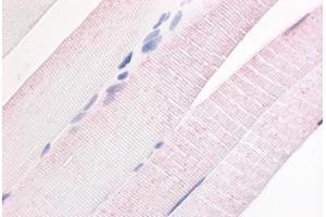 Human Skeletal Muscle (formalin-fixed, paraffin-embedded) stained with PDE7A antibody ABIN213530 at 20 ug/ml followed by biotinylated goat anti-rabbit IgG secondary antibody ABIN481713, alkaline phosphatase-streptavidin and chromogen. (PDE7A 抗体  (N-Term))