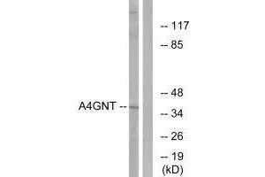 Western blot analysis of extracts from K562 cells, using A4GNT antibody. (A4GNT 抗体)