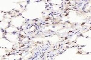 Immunohistochemistry of paraffin embedded mouse lung using F480 (ABIN7073801) at dilution of 1:1000 (400x lens) (F4/80 抗体)