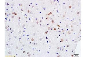 Formalin-fixed and paraffin embedded rat brain labeled with Anti DENTT Polyclonal Antibody, Unconjugated  at 1:200 followed by conjugation to the secondary antibody and DAB staining (TSPY-Like 2 抗体  (AA 251-350))