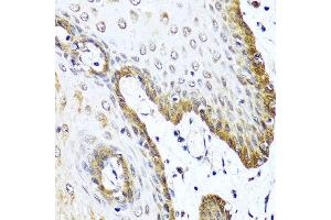 Immunohistochemistry of paraffin-embedded human esophagus using VIP antibody at dilution of 1:100 (40x lens). (Vip 抗体)