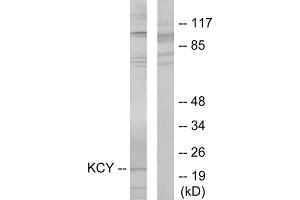Western blot analysis of extracts from HeLa cells, using KCY antibody. (KCY (N-Term) 抗体)