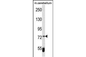 Western blot analysis in mouse cerebellum tissue lysates (35ug/lane). (ZBTB39 抗体  (AA 231-258))