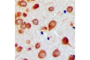 Immunohistochemical analysis of BMP7 staining in human brain formalin fixed paraffin embedded tissue section.