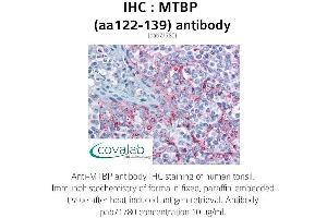 Image no. 2 for anti-MDM2 Binding Protein (MTBP) (AA 122-139) antibody (ABIN1737106) (MTBP 抗体  (AA 122-139))