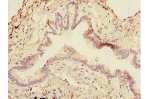 Immunohistochemistry of paraffin-embedded human lung tissue using ABIN7160270 at dilution of 1:100 (DCP1A 抗体  (AA 303-582))