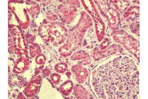 Immunohistochemistry (IHC) image for anti-Zinc Finger, CCCH-Type with G Patch Domain (ZGPAT) (C-Term) antibody (ABIN1804811)
