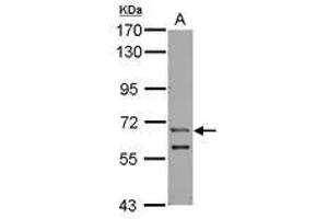 Image no. 1 for anti-Zinc Finger Protein, Y-Linked (ZFY) (AA 431-730) antibody (ABIN1501819) (ZFY 抗体  (AA 431-730))