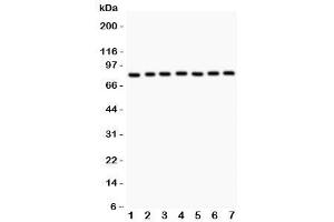 Western Blotting (WB) image for anti-Proteasome (Prosome, Macropain) 26S Subunit, Non-ATPase, 14 (PSMD14) (AA 362-632) antibody (ABIN3032352)